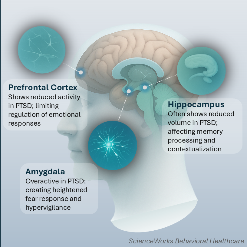 Illustration of the human brain showing the amygdala, hippocampus, and prefrontal cortex labeled — regions affected by PTSD and trauma-related stress.