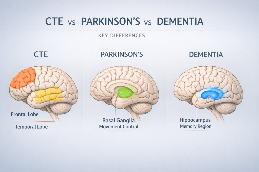 Medical educational illustration comparing CTE, Parkinson’s disease, and dementia with highlighted brain regions representing memory, movement, and cognitive function in a calm blue-gray diagram.