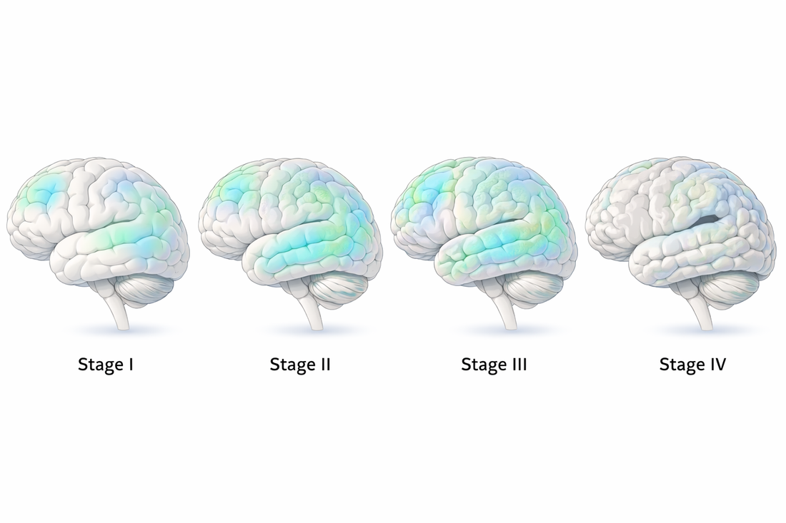 Medical illustration of the human brain with highlighted cortical regions affected in traumatic encephalopathy and neurodegeneration.